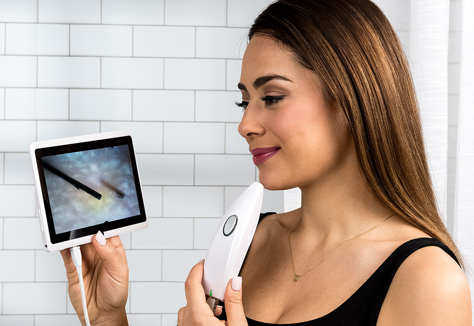 Professional Laser Permanent Hair Remover Sharper Image